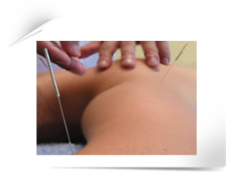 chinese acupuncture at chisense clinic, aldgate, city, whitechapel, london