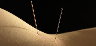 Timesonline: Scientists find acupuncture can help to relieve chronic back pain